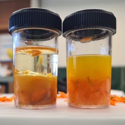 Körpergifte Vitamine gesund oder schädlich