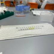 Exkursion der Klasse 11 – Nachweis einer Infektion